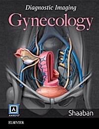 Diagnostic Imaging: Gynecology (Hardcover, 2, Revised)