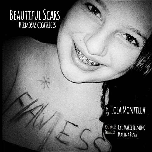 Beautiful Scars Hermosas Cicatrices (Paperback)