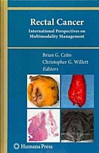 Rectal Cancer: International Perspectives on Multimodality Management (Hardcover)