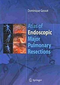 Atlas of Endoscopic Major Pulmonary Resections (Paperback, 2010)