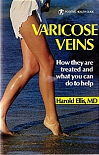 Varicose Veins: How They Are Treated and What You Can Do to Help (Positive Health Guide) (Paperback)