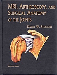 MRI, Arthroscopy, and Surgical Anatomy of the Joints (Hardcover, 1st)
