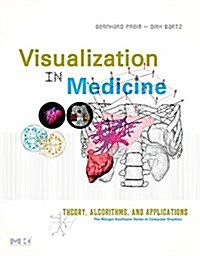 Visual Computing for Medicine: Theory, Algorithms, and Applications (Paperback)