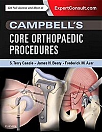 Campbells Core Orthopaedic Procedures (Hardcover)