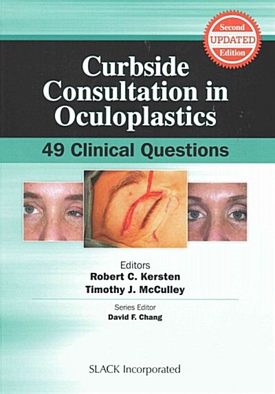 Curbside Consultation in Oculoplastics: 49 Clinical Questions (Paperback, 2)