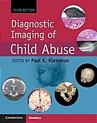 Diagnostic Imaging of Child Abuse (Hardcover, 3 Revised edition)