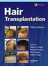 Hair Transplantation (Hardcover, 5, UK)