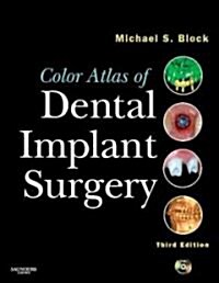 [중고] Color Atlas of Dental Implant Surgery (Hardcover, DVD, 3rd)