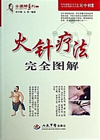 全圖解系列叢书:火针療法完全圖解 (平裝, 第1版)