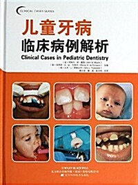 兒童牙病臨牀病例解析 (精裝, 第1版)