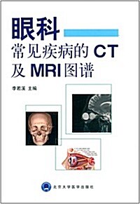 眼科常見疾病的CT及MRI圖谱 (平裝, 第1版)