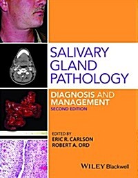 Salivary Gland Pathology: Diagnosis and Management (Hardcover, 2)