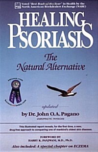 Healing Psoriasis (Paperback)