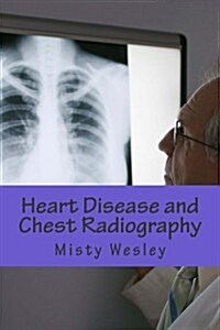 Heart Disease and Chest Radiography (Paperback)