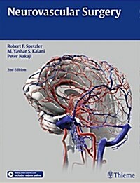 Neurovascular Surgery (Hardcover, 2)