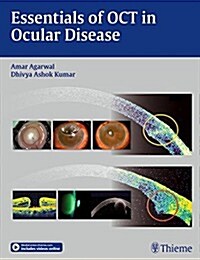 Essentials of Oct in Ocular Disease (Hardcover)