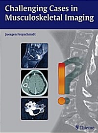 Challenging Cases in Musculoskeletal Imaging (Hardcover)