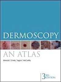 Dermoscopy (Paperback, Pass Code, 3rd)