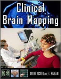 Clinical brain mapping 1st ed