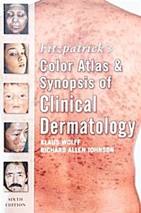 Fitzpatricks Color Atlas and Synopsis of Clinical Dermatology (Paperback, 6th)