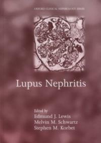 Lupus nephritis