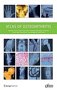 Atlas of Osteoarthritis (Paperback, 2014 ed.)