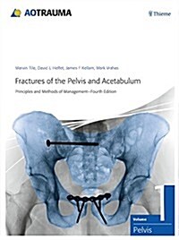 Fractures of the Pelvis and Acetabulum (Ao): Principles and Methods of Management (Hardcover, 4)