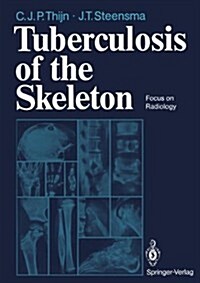 Tuberculosis of the Skeleton: Focus on Radiology (Hardcover)