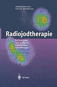 Radiojodtherapie: Bei Benignen Und Malignen Schilddra1/4senerkrankungen (Hardcover)