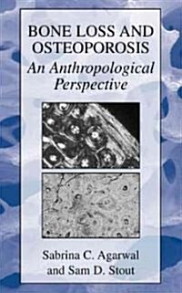 Bone Loss and Osteoporosis: An Anthropological Perspective (Hardcover, 2003)