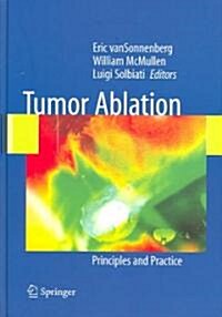 Tumor Ablation: Principles and Practice (Hardcover, 2005)