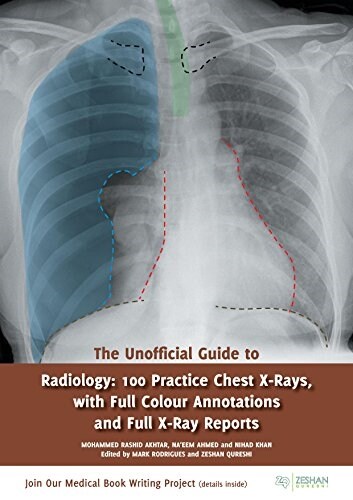 The Unofficial Guide to Radiology: 100 Practice Chest X Rays with Full Colour Annotations and Full X Ray Reports (Paperback)