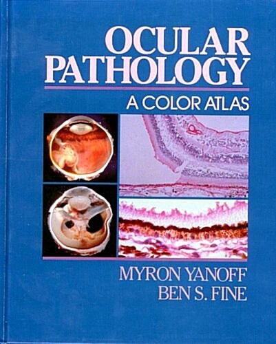Ocular Pathology (Hardcover)