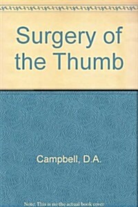 Surgery of the Thumb (Hardcover)