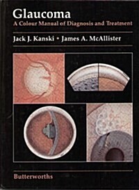 Glaucoma (Hardcover)