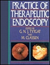 The Practice of Therapeutic Endoscopy (Hardcover)