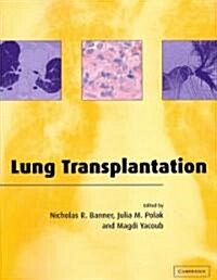 Lung Transplantation (Paperback, 1st)