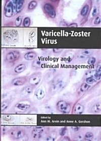 Varicella-Zoster Virus (Hardcover)