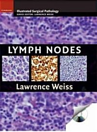 Lymph Nodes (Hardcover)