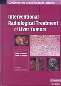 Interventional Radiological Treatment of Liver Tumors (Hardcover)