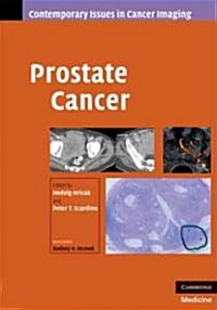 Prostate Cancer (Hardcover)