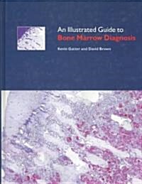 An Illustrated Guide to Bone Marrow Diagnosis (Hardcover, Illustrated)