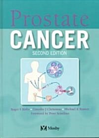 [중고] Prostate Cancer (Hardcover, 2nd, Subsequent)