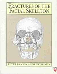 Fractures of the Facial Skeleton (Paperback)