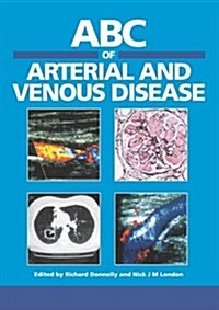 ABC of Arterial and Venous Diseases (Paperback)