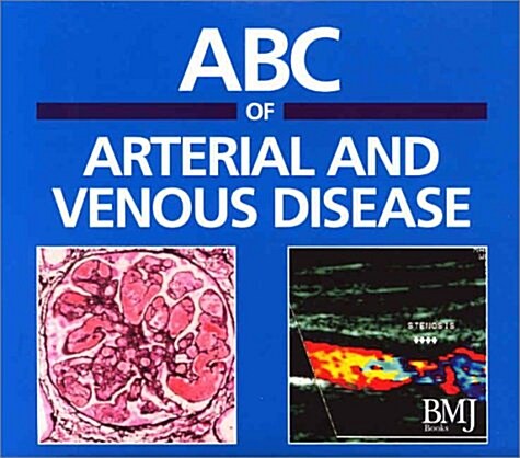 ABC of Arterial And Venous Disease Cd-rom Slide Set (Cd-rom for Windows) (CD-ROM)