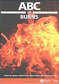 ABC of Burns (Paperback)