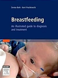 Breastfeeding: An Illustrated Guide to Diagnosis and Treatment [With CDROM] (Hardcover)