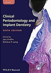 Clinical Periodontology and Implant Dentistry, 2 Volume Set (Hardcover, 6, Edition, 2 Volu)