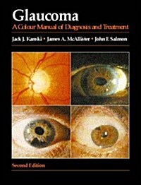 Glaucoma (Hardcover, 2nd, Subsequent)